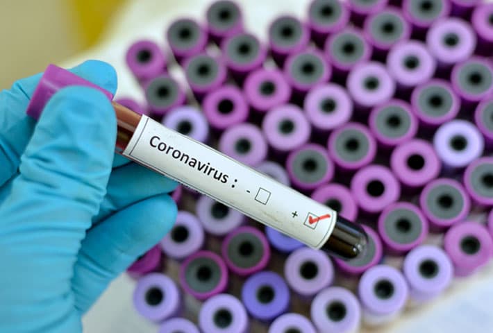 CORONAVIRUS, LA GUERRA DESATADA POR UN ENEMIGO SILENCIOSO